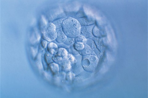 http://zhuhai.quanwangkm.com/post/190.html|珠海人工试管